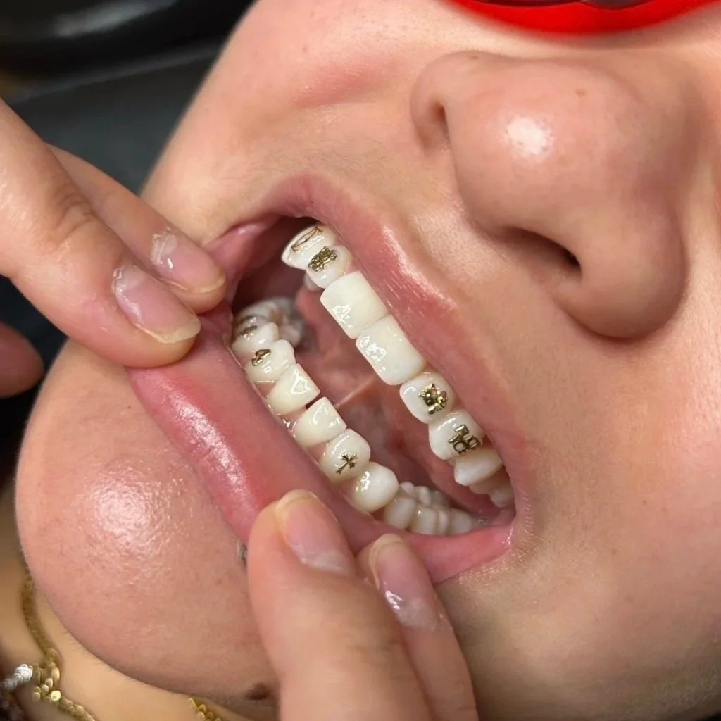 18k Yellow Gold Tooth Gems