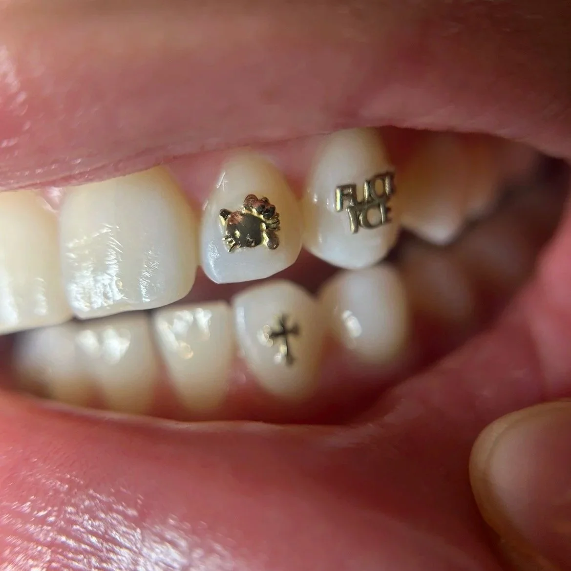 18k Yellow Gold Tooth Gems
