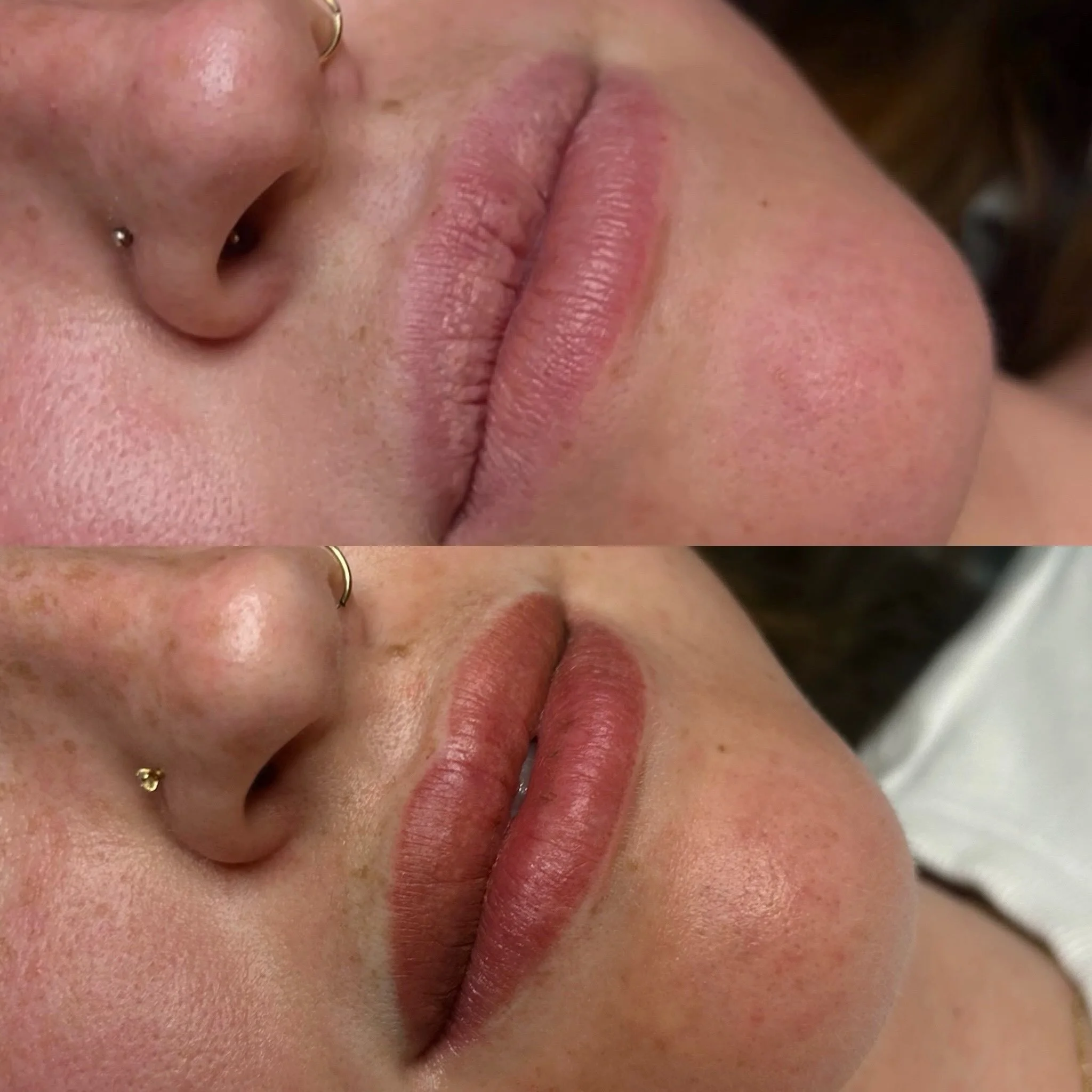 💋💋💋💋💋💋 had to hard post this lip blush/ fordyce spot journey!!!! And getting back to my split screen roots lol. 3rd slide healed after 1 session MWAH