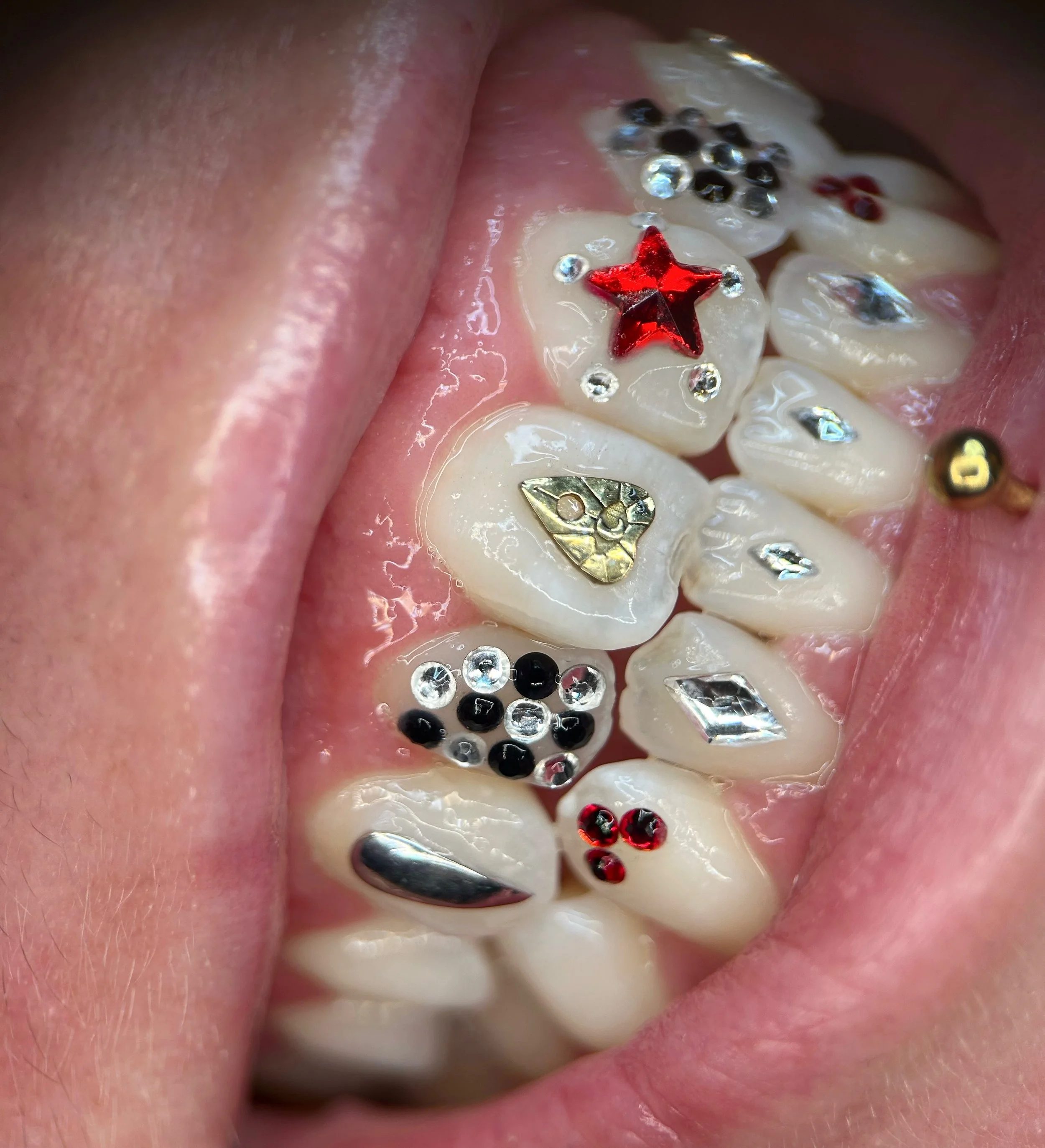 12 TEETH 41 JEWELS :O ft an 18k white gold fang, an 18k yellow gold planchette~ and 2 checkerboard teeth 🧮♟️🩸

@dharma_tattoo_collective &hearts;️