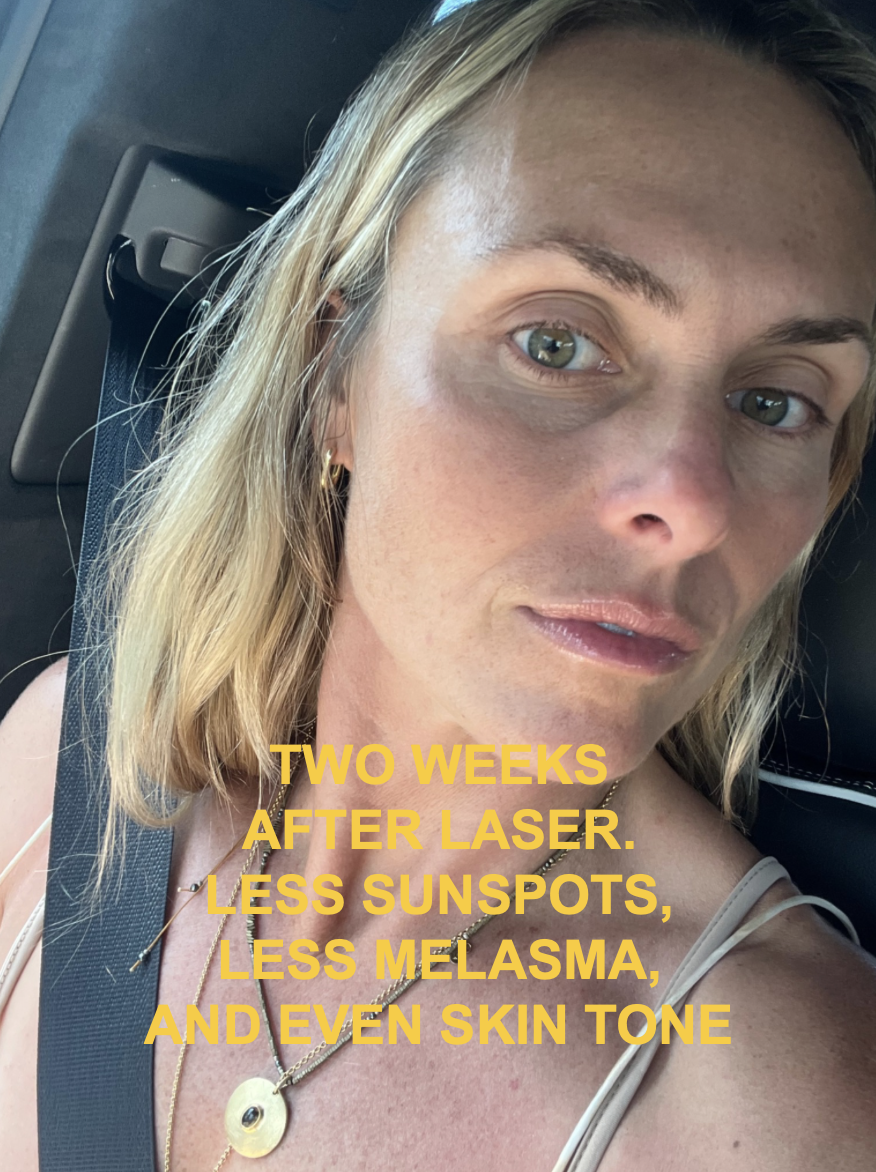 Hale_8.png