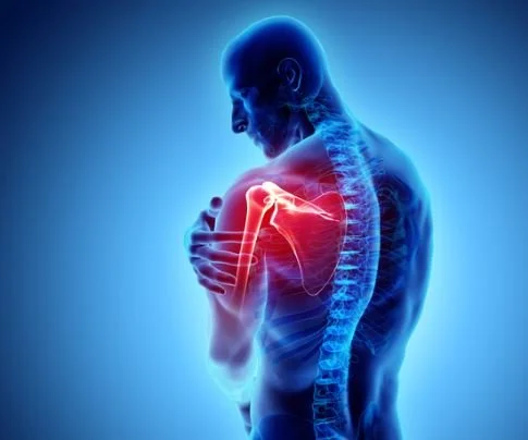 FROZEN SHOULDER  - A COMPREHENSIVE APPROACH