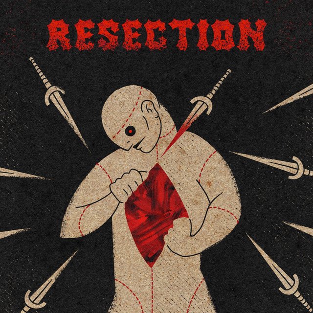 KIPSY - Resection.jpg