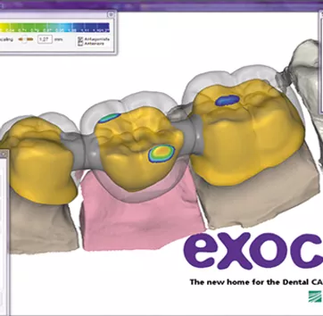 Exocad Software 