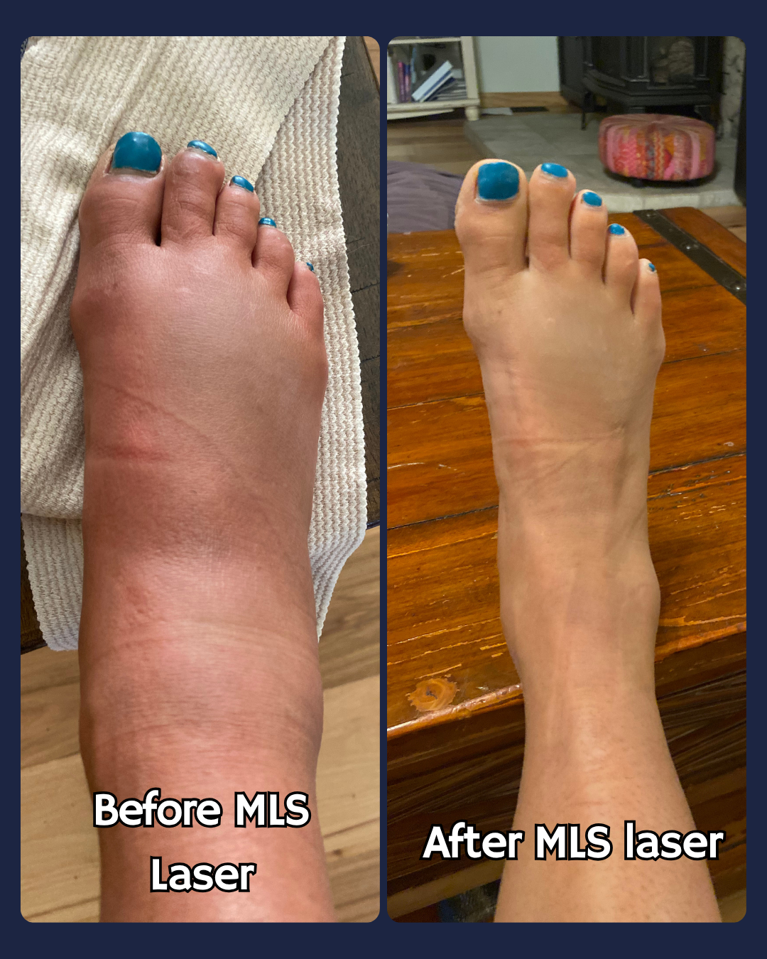 Class 4 MLS Laser Therapy vs. Red Light Therapy: What’s the Difference?
