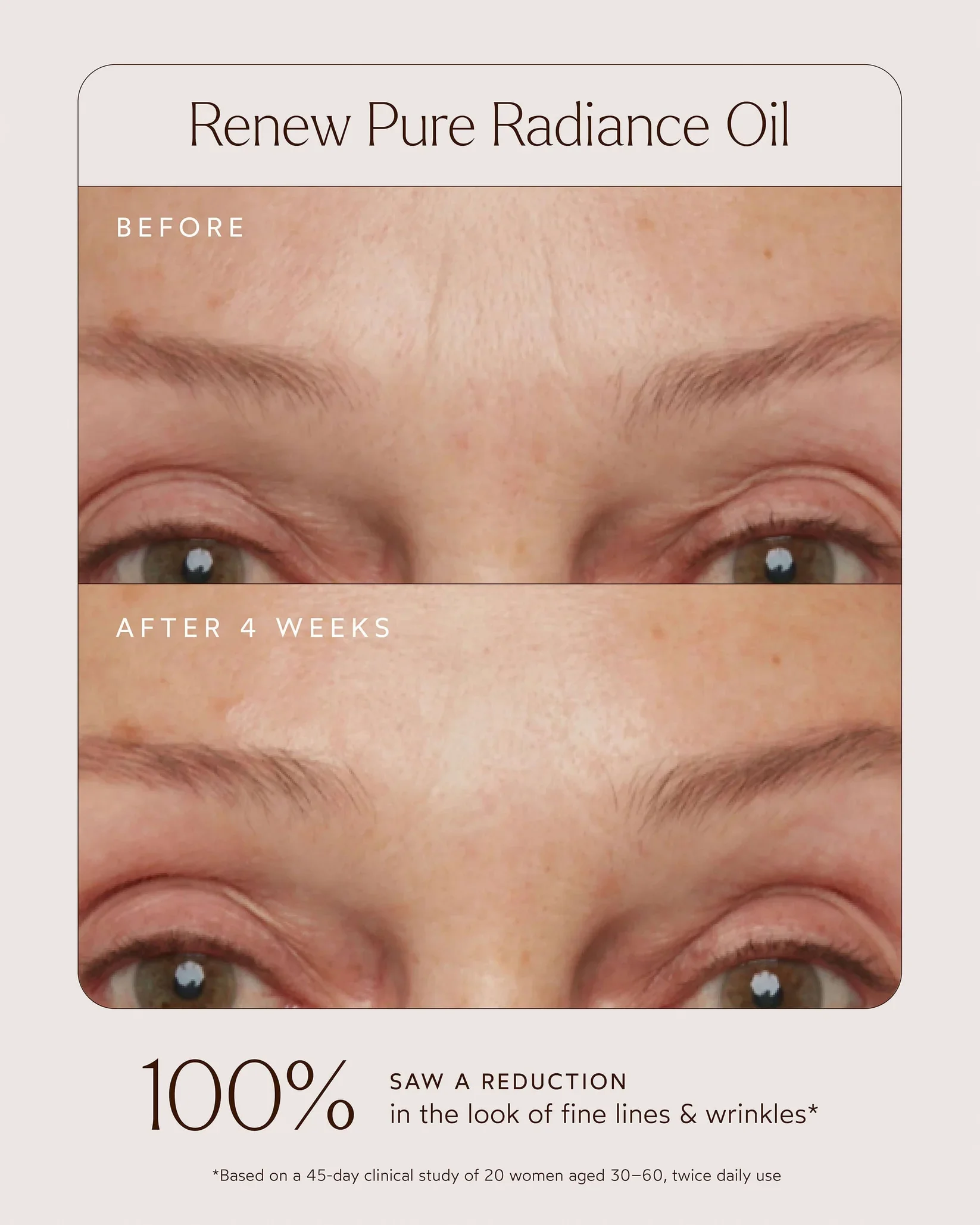 TrueBotanicals_TriedTrueKit_BA_06_1646x.webp