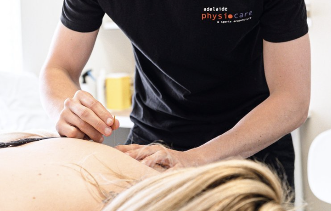 Professional Dry Needling in Adelaide: Targeted Muscle Relief