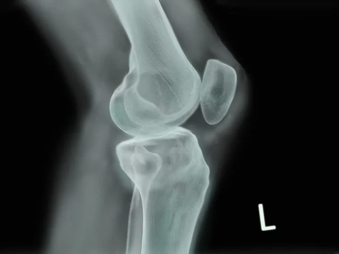 Knee X-Ray, 3dsMax, 2010.
