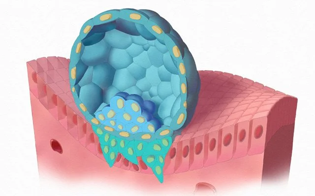 Trophoblast Invasion, 3dsMax and Photoshop, 2010.
