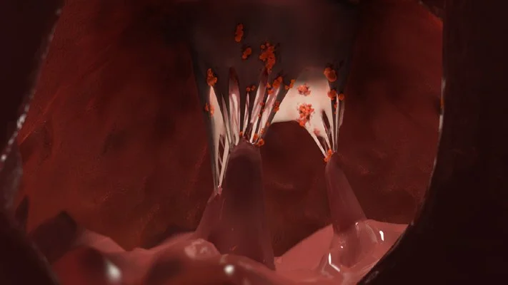 Epicarditis, 3dsMax, 2010.