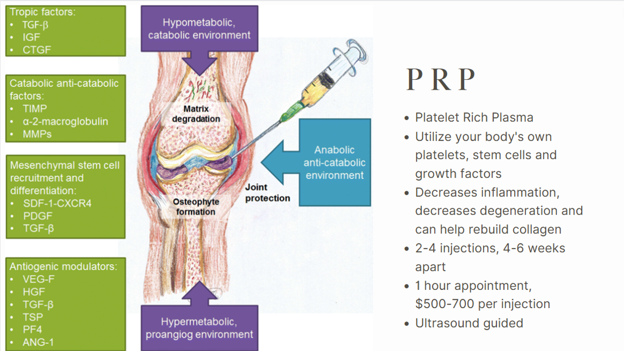 prp arthritis 10.png