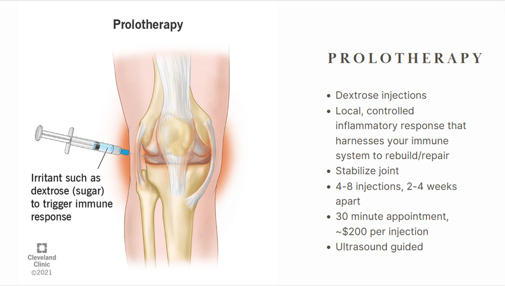 prolotherapy arthritis 11.png