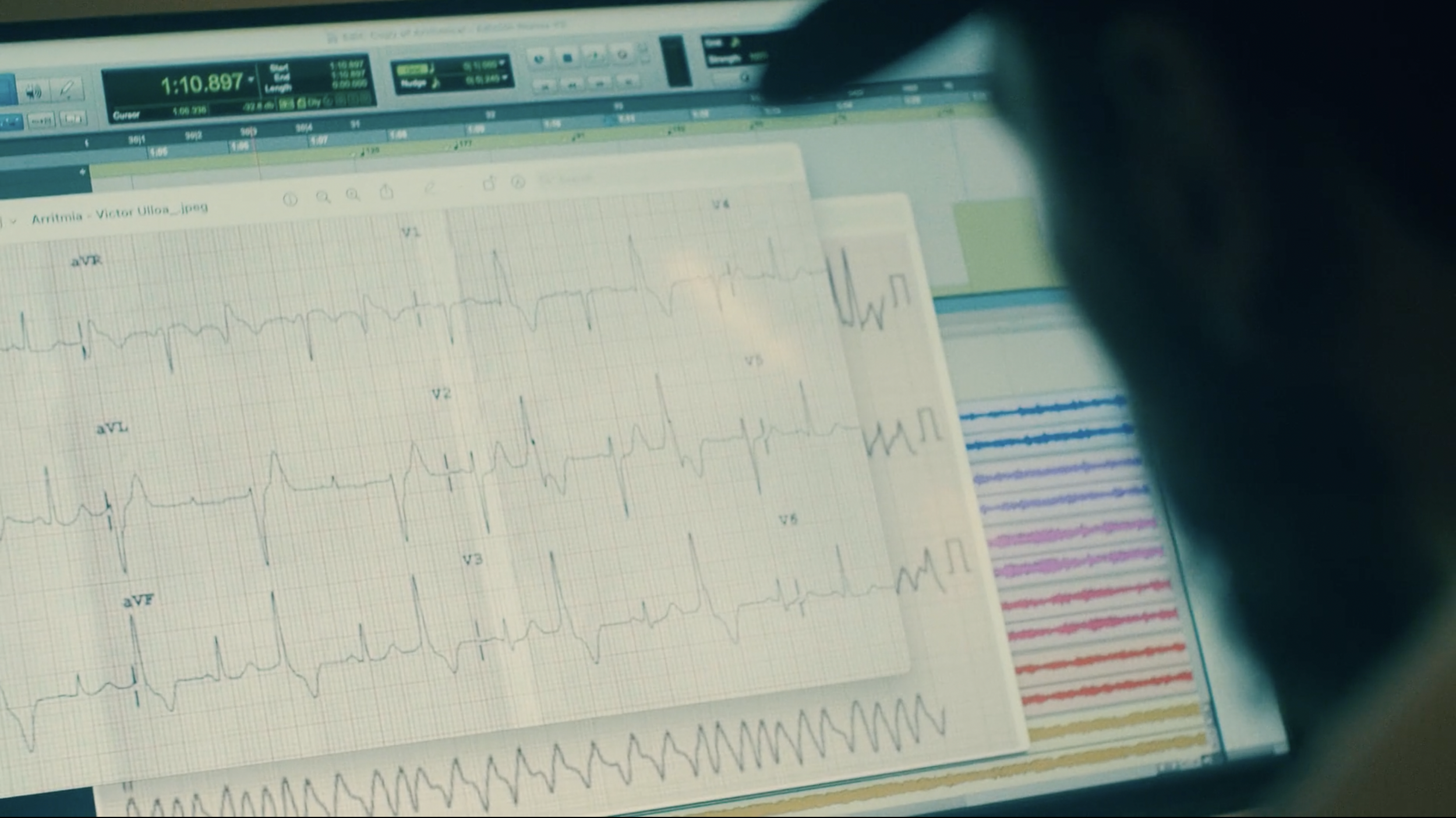 SONGS WITH ARRHYTHMIA