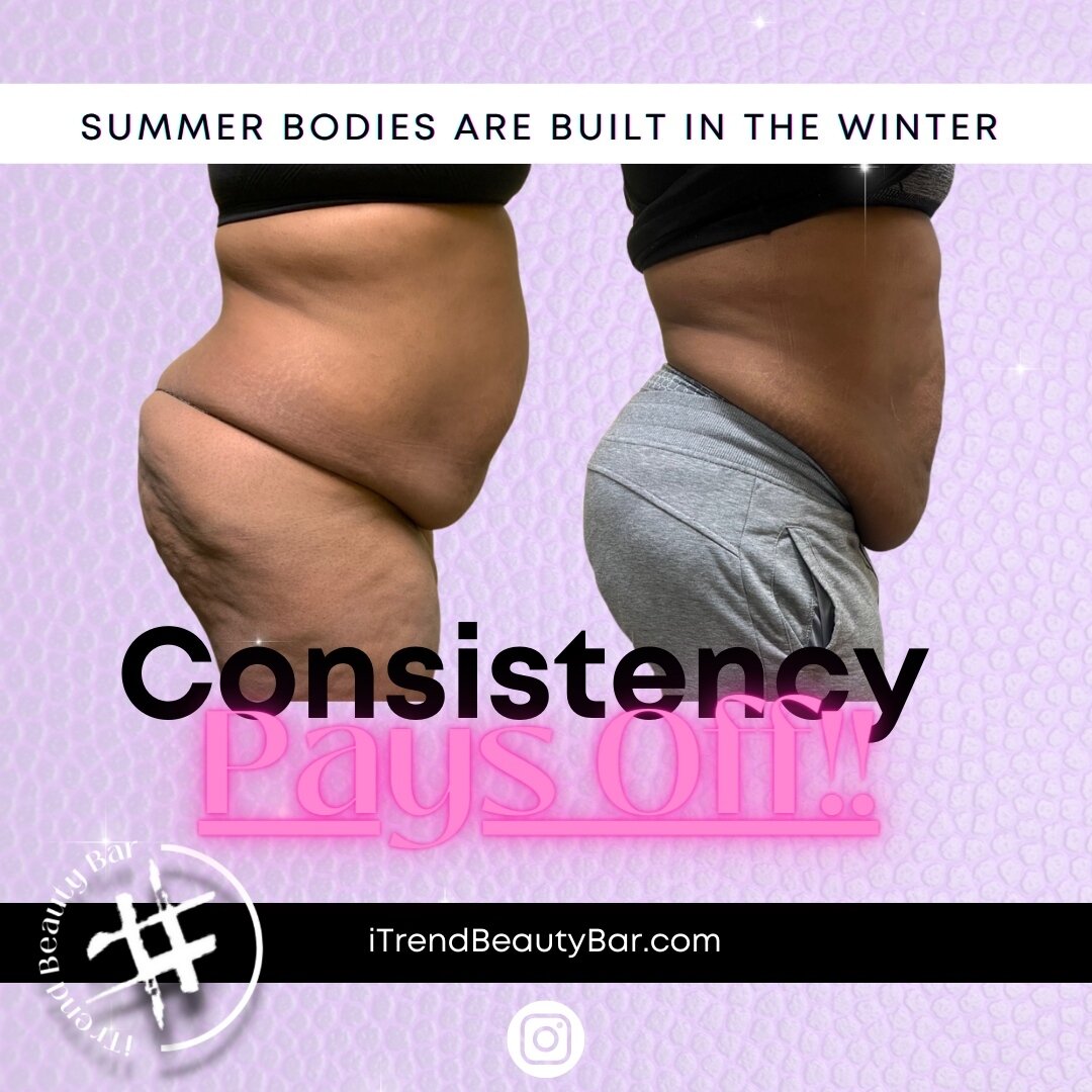 The early bird gets the worm truly when it comes to body sculpting. Although I would love to help you fit in that 2 piece 2 days before your trip, it won't happened over night. A minimum of 6 sessions are recommended to get started on your contouring