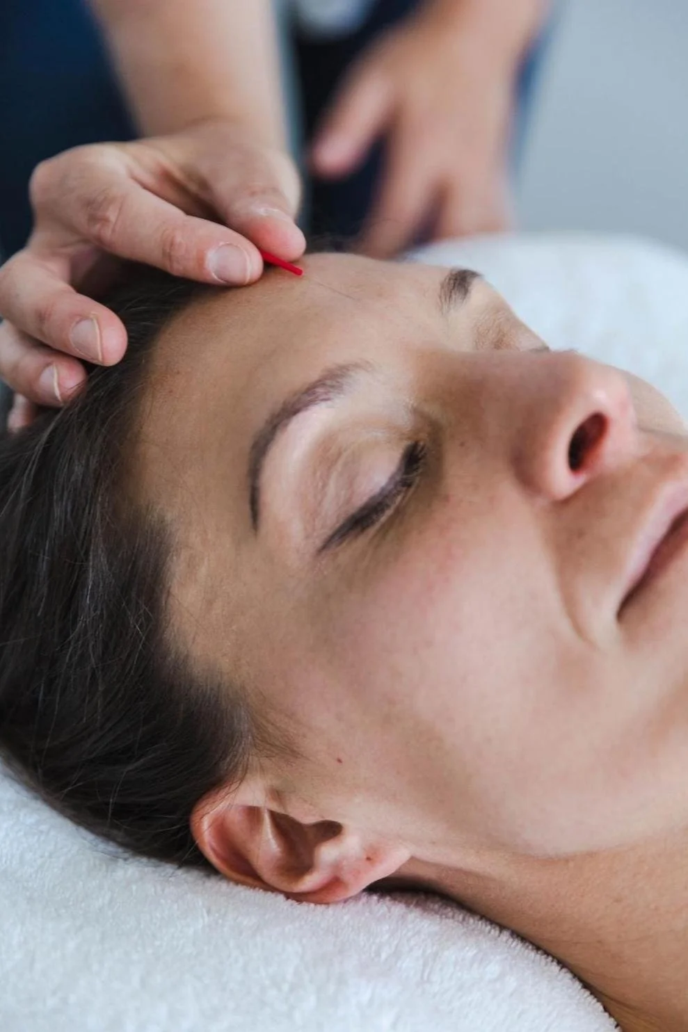 Anxiety + Stress Relief — Integrative Acupuncture