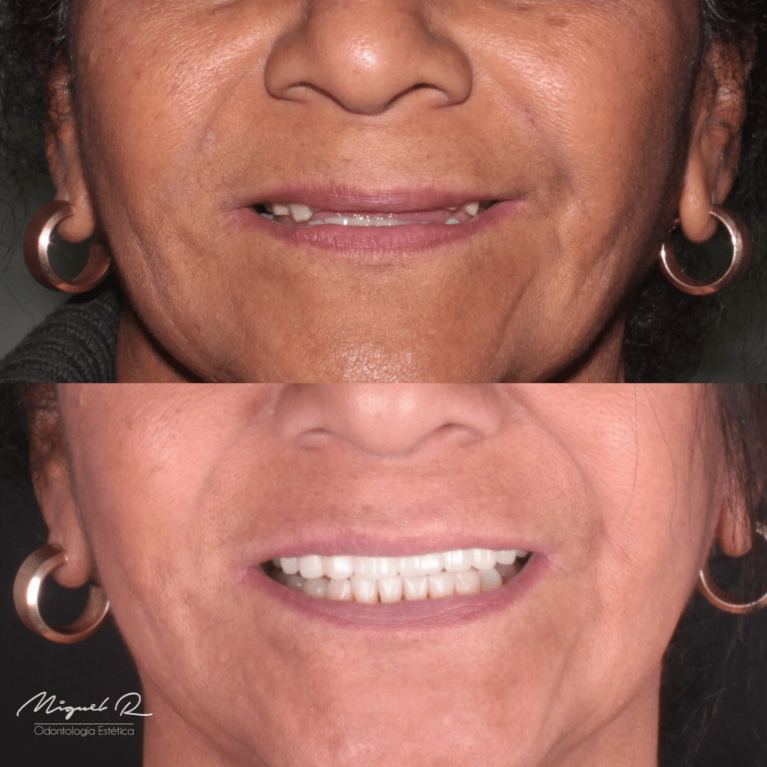 Implantes Dentales Polanco.PNG