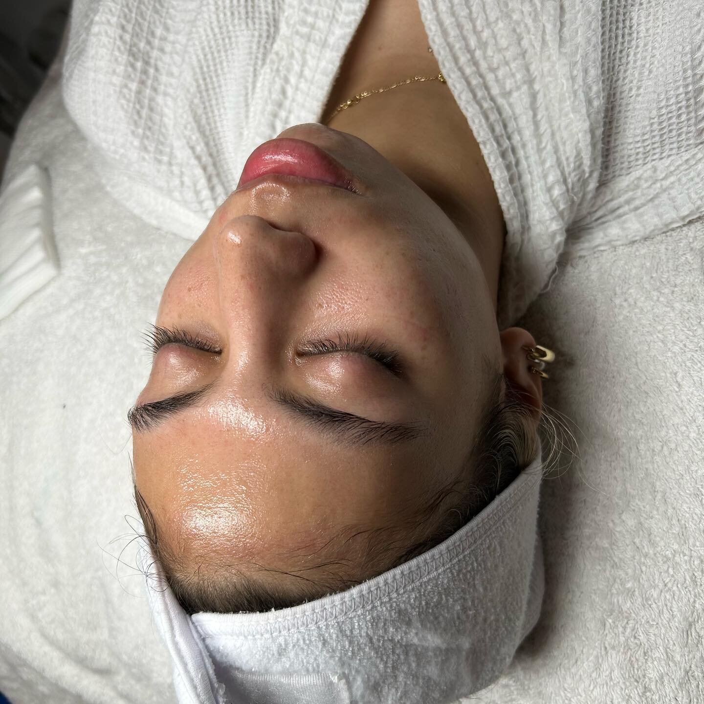 You can be this glowy too 🫧 🍩 
Our Glazed Donut Facial includes dermaplaning, signature Hydrafacial and LED light for refreshed, hydrated and healthy skin. Ready to book? Use the link in bio to get glowing for summer 💫 757-769-7100

#hydrafacial #