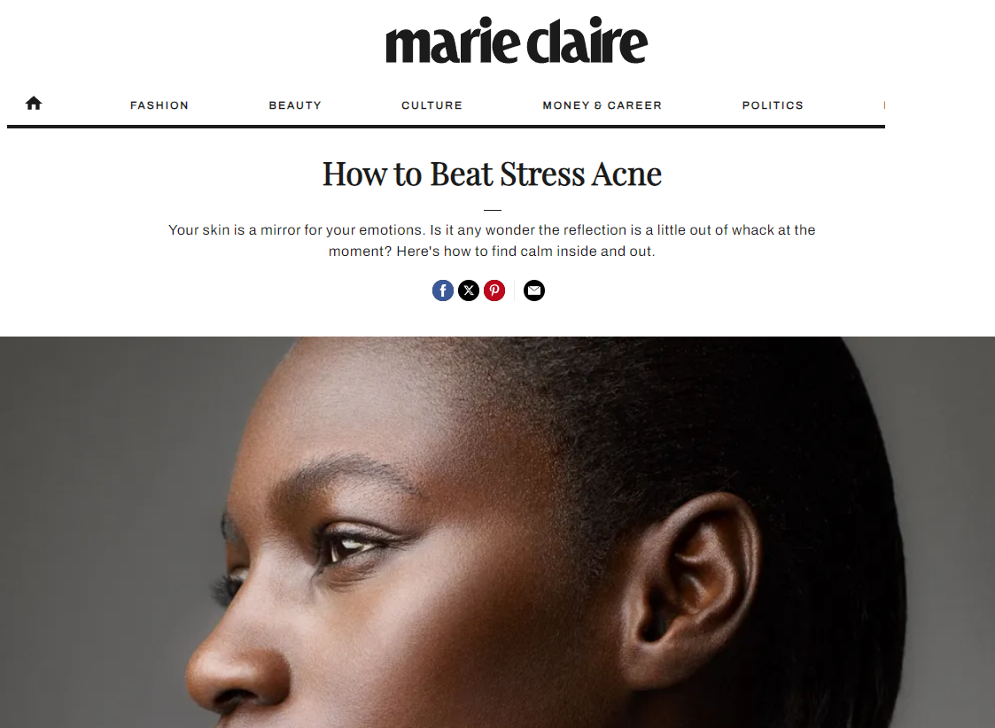 Marie Clair How to Beat Stress Acne Sept 14, 2020.png