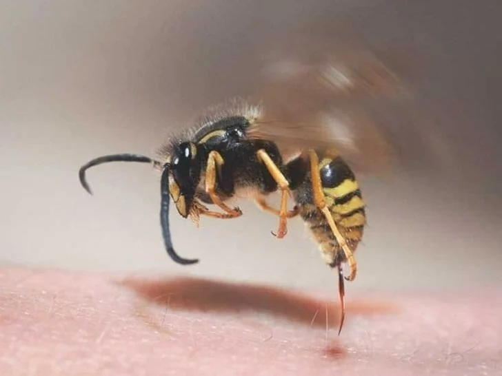 How To Treat Wasp Stings.