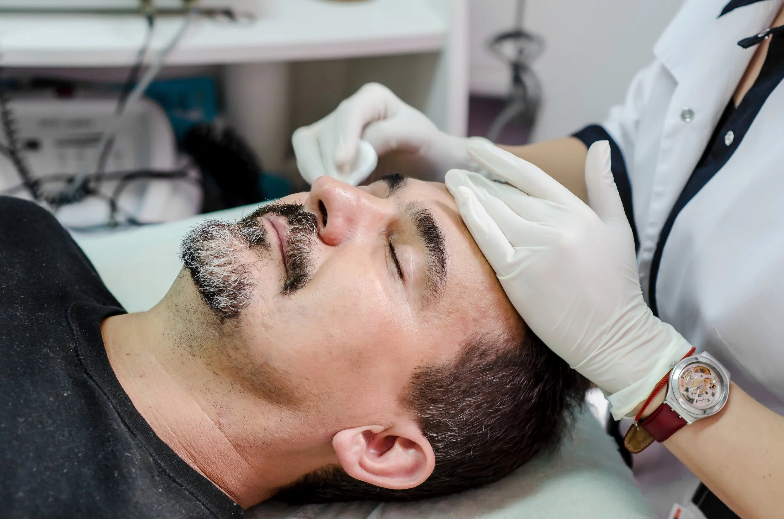 The Link Between Acne & Hormones