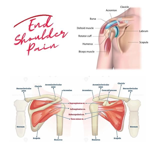 Top 10 Exercises to reduce Shoulder Pain