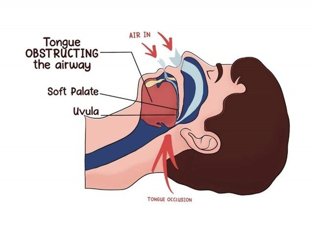 Airway Basic Anatomy and Physiology — iRescue