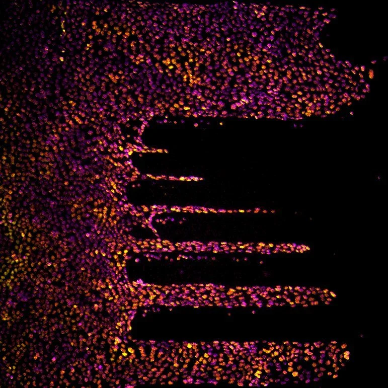 SYMBIOSE Lab UMONS Sylvain GABRIELE ERK signaling Collective Migration Confinement
