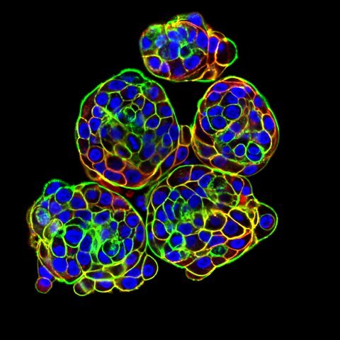 Spheroids of breast epithelial cells