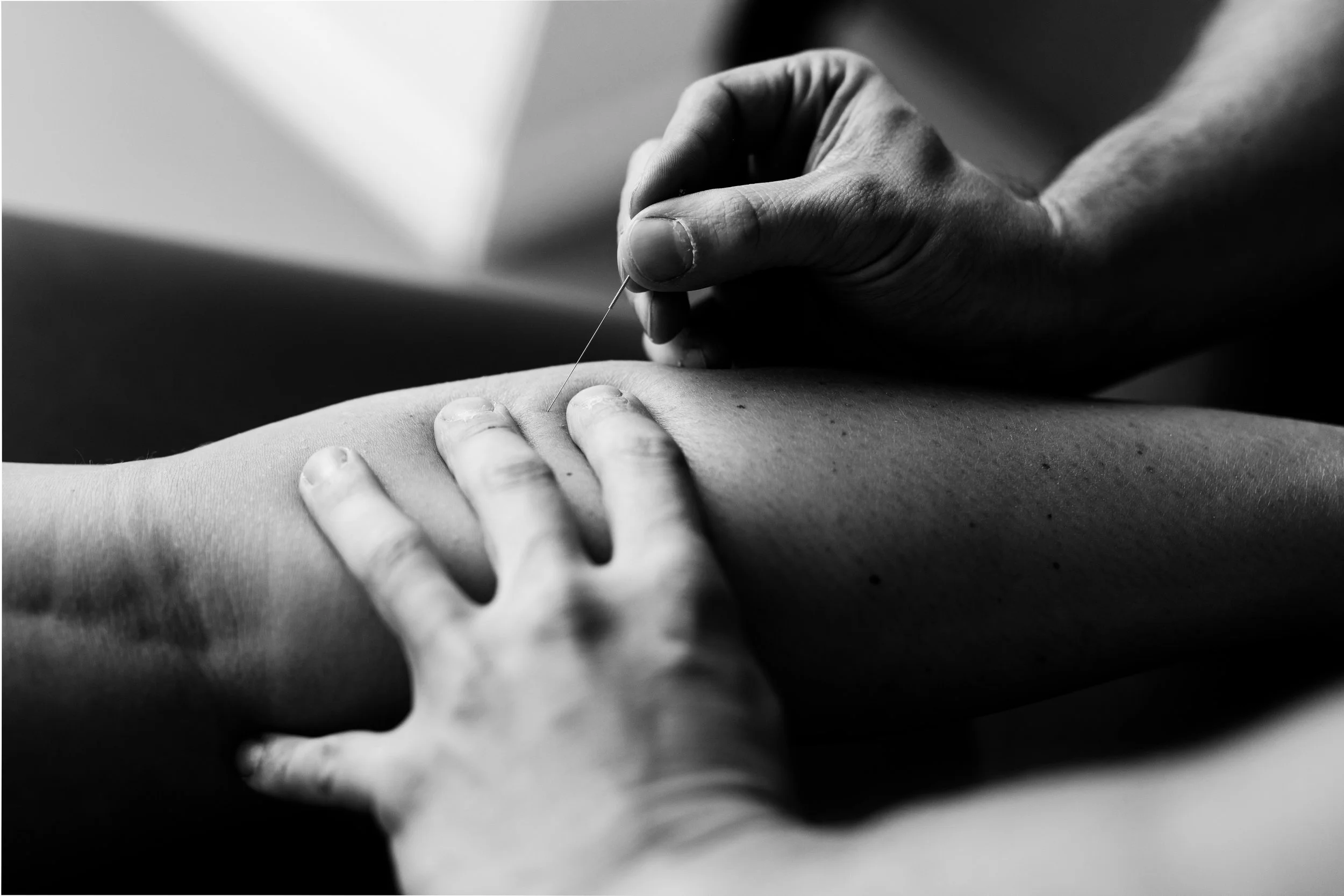 Van Ranst Kine - dry needling