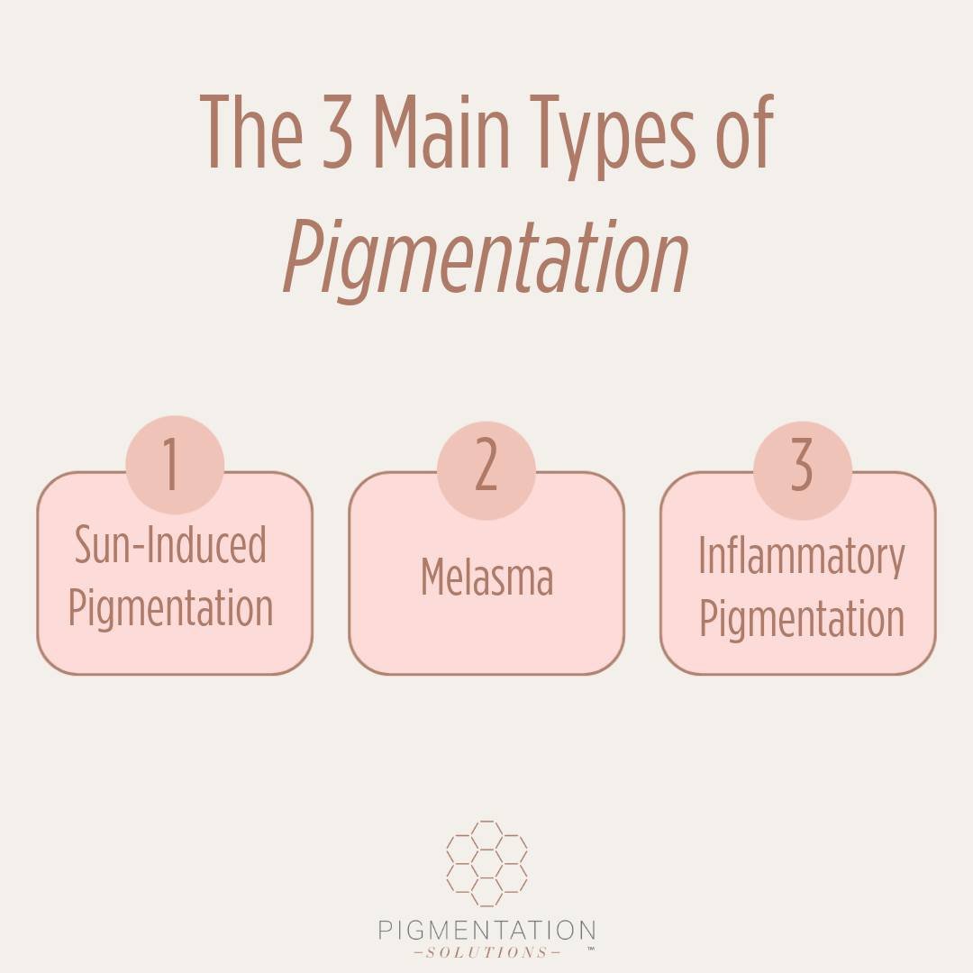 ✨ Reveal Radiance. Repair Pigment. Reclaim Confidence. ✨⁠
⁠
Pigmentation issues don&rsquo;t have to be your skin&rsquo;s story forever. Whether it&rsquo;s sunspots, hormonal melasma, or post-acne marks&mdash;Rhonda Allison&rsquo;s Pigmentation Soluti