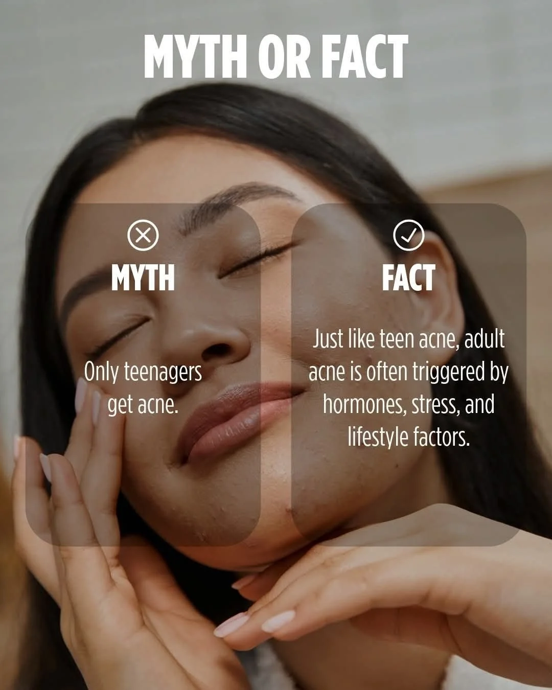 Adult acne is a message, not just a breakout. 🍊⁠
⁠
And it&rsquo;s almost never just one thing. Hormones, gut health, stress, and diet all play a role &mdash; and your skin is usually the first place those imbalances show up.⁠
⁠
A few small shifts th