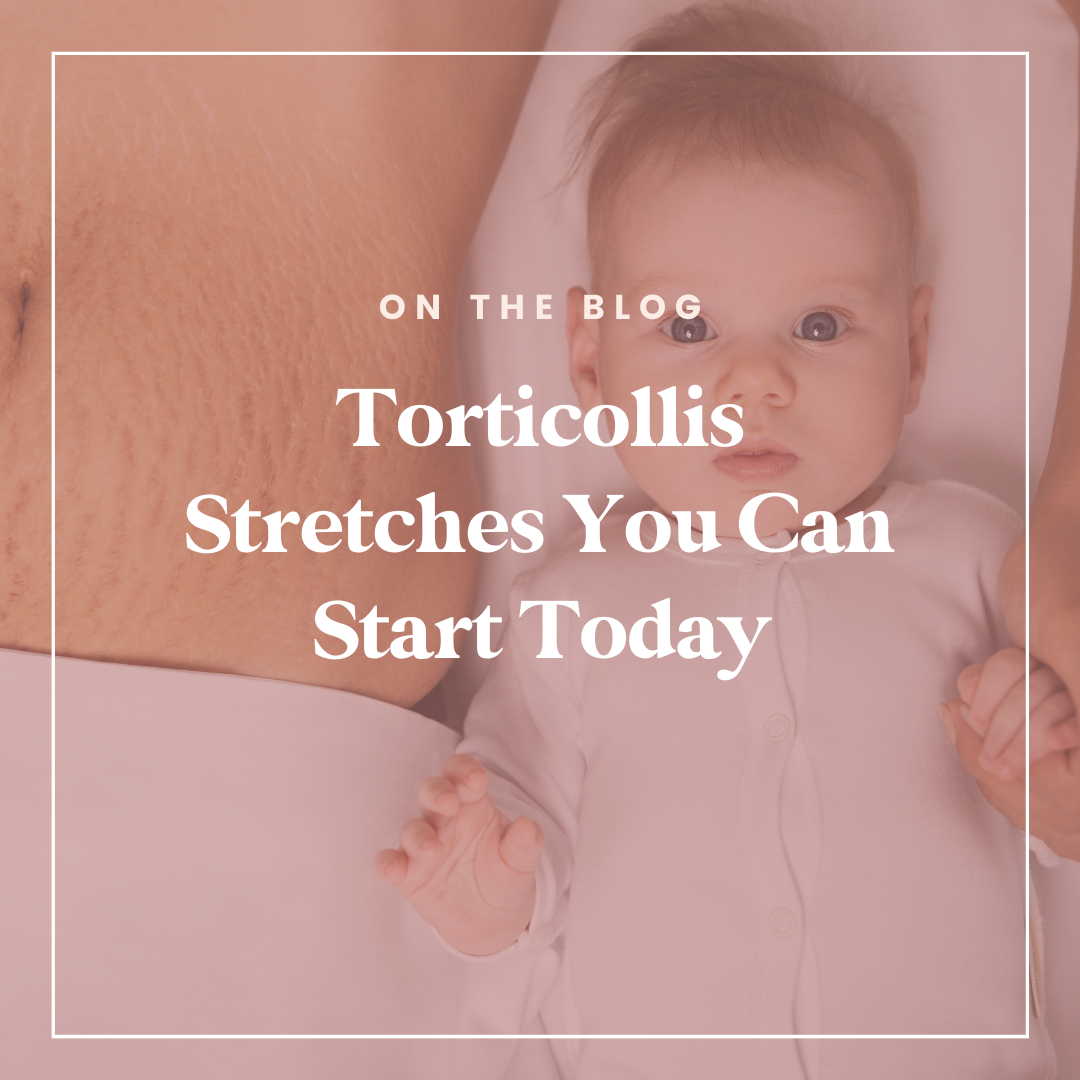 Torticollis Stretches You Can Do At Home