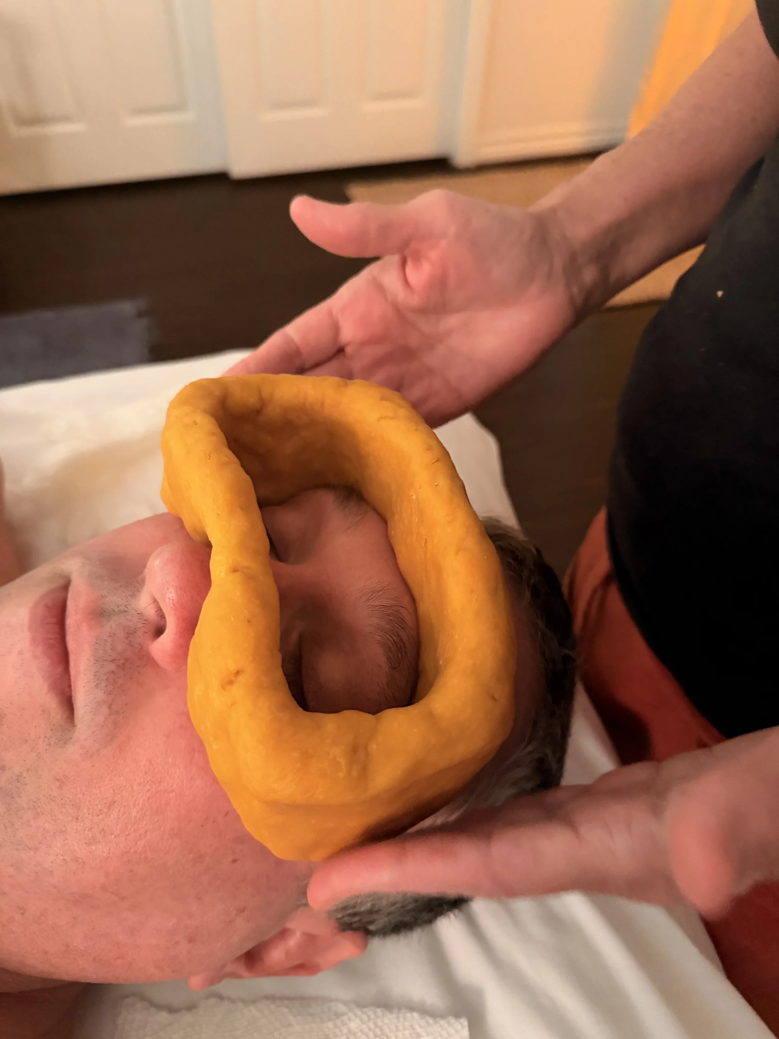 Practitioner pouring warm herbal ghee into a natural dough ring around client eyes during an Ayurvedic Netra Basti treatment