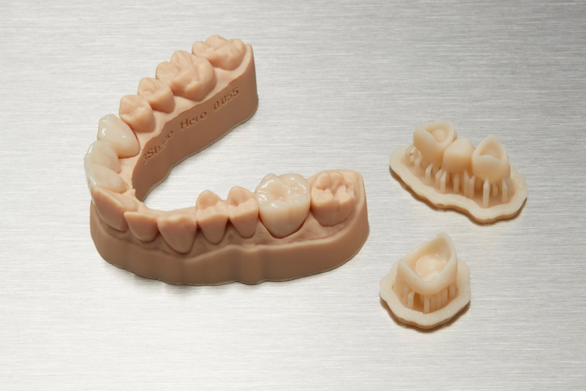 impression 3d sla prothèse dentaire