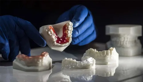Modèle dentaire imprimé en 3D résine