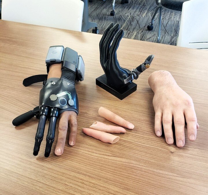 SRT's upper extremity team was in Milwaukee last week where they presented upper extremity prosthetic options to hand surgeons, residents and OT's. 

Our team treats 80+ new upper extremity patients a year making them a very experienced team to achie