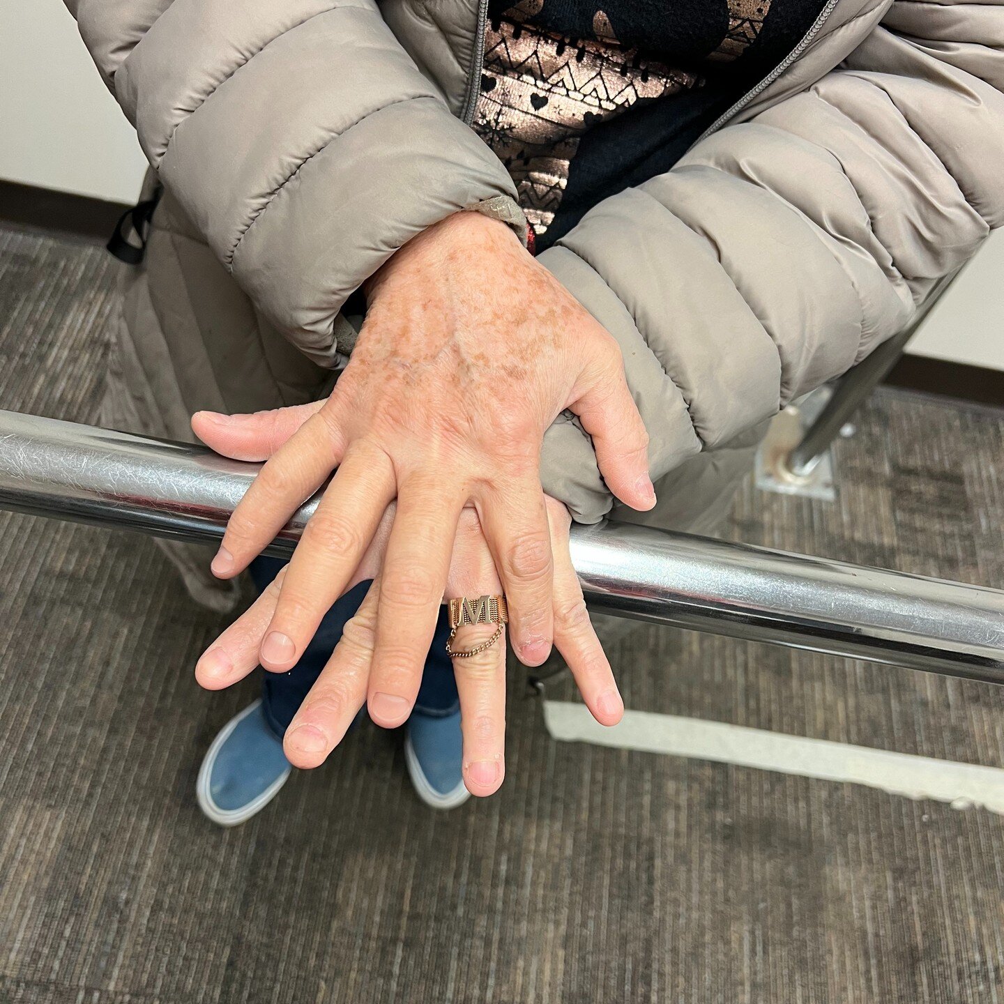 Can anyone identify which finger(s) are actually silicone restoration(s)? 

These prosthetic devices are crafted from a transparent silicone glove that closely replicates the unaffected side, featuring intricate details such as wrinkles, veins, knuck
