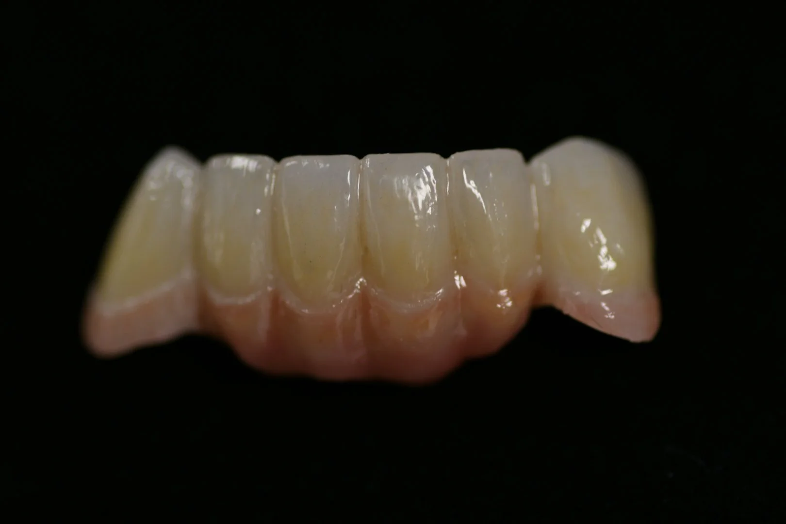 Zirconia Bridges