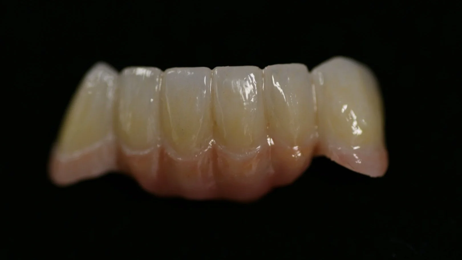 Zirconia Bridges