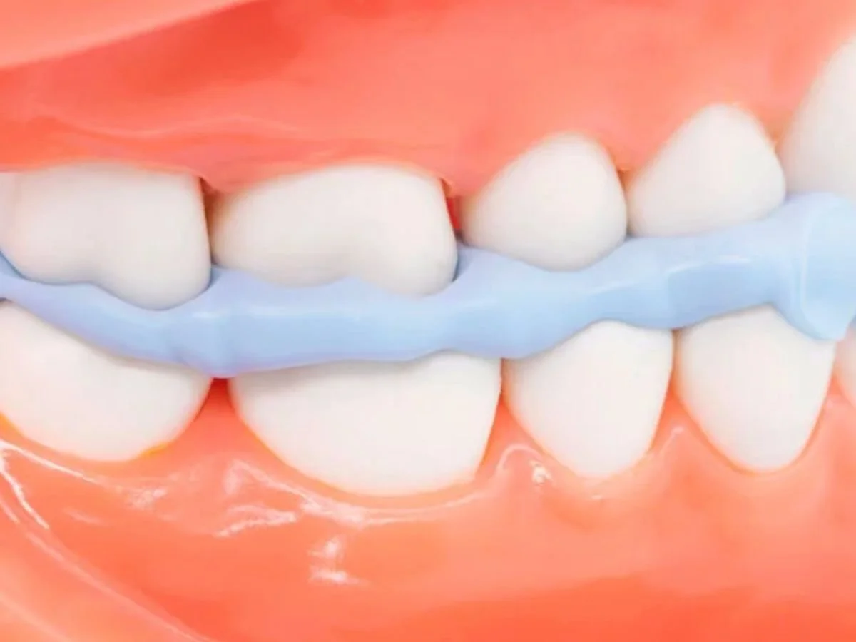 Huge Dental Bite Registration Normal Set Chairside Solutions huge-dental-bite-registration-normal-set-chairside-solutions