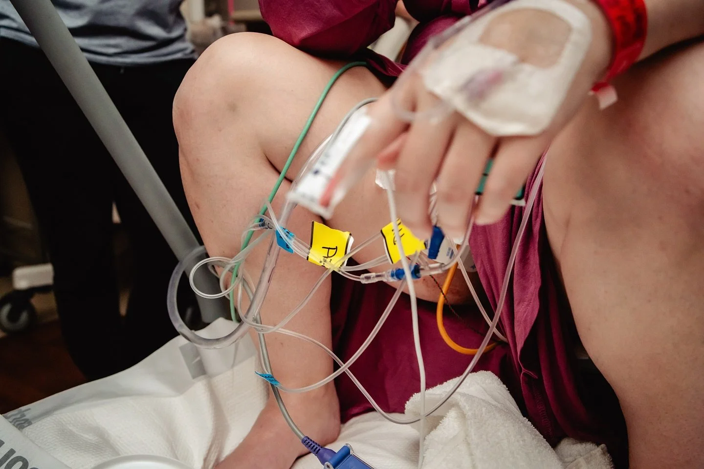 Inductions [can] be like ⬆️. Magnesium, pitocin, pulse ox, urinary catheter, intrauterine catheter, and internal fetal monitor. And believe it or not, this badass mom did it all unmedicated. Her birth threw big curveballs, and she took each one in st