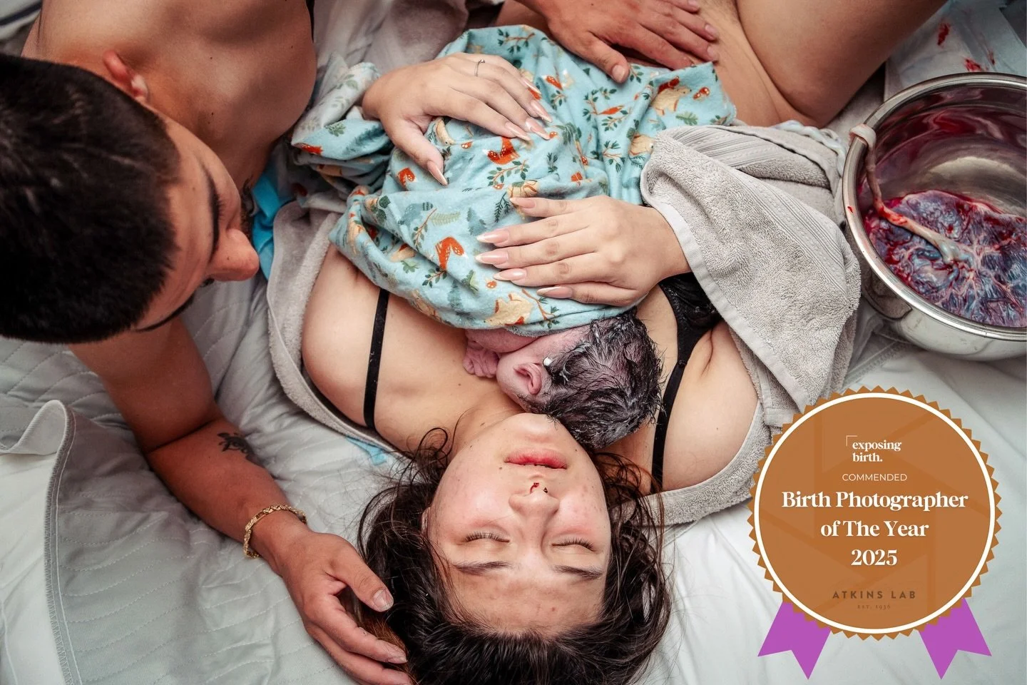 🏆After-Birth🏆 An image that captures the realness of the golden hour: the birth of the placenta, skin-to-skin and family bonding, and a moment for rest as the mind catches up with everything the body is experiencing.