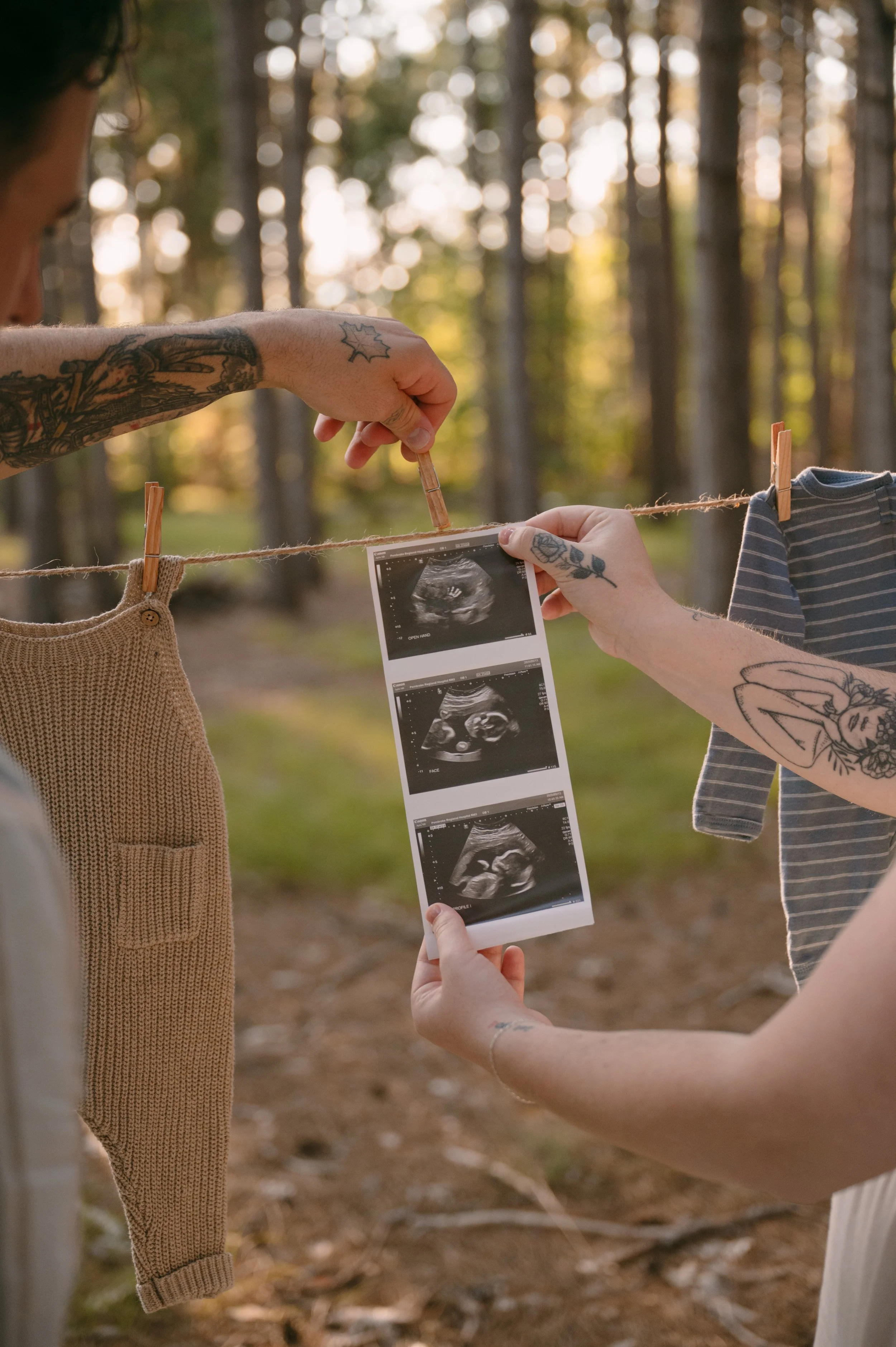 Two women hanging baby clothes with ultrasound images printed on them on a clothesline in a wooded outdoor area.