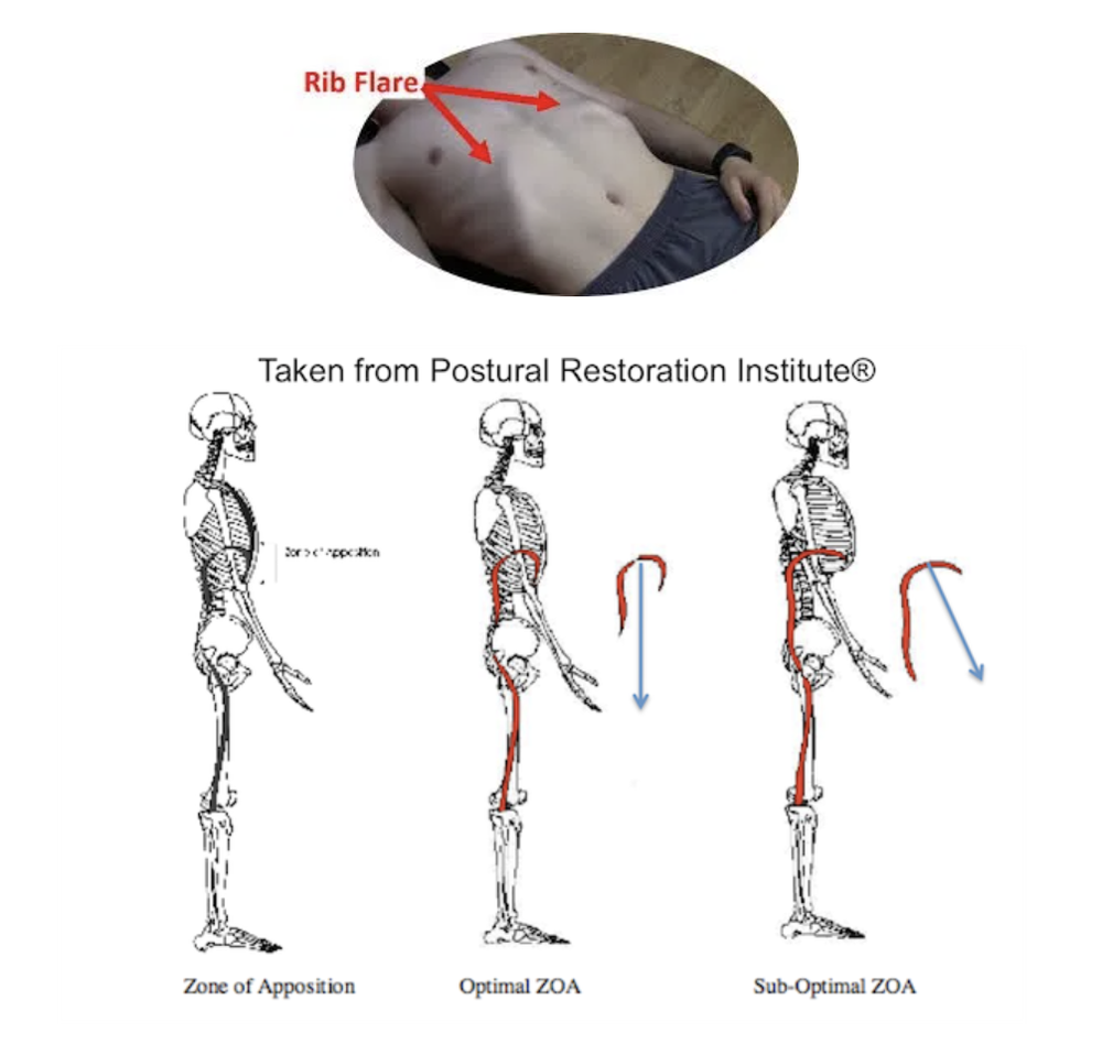 Guest Post Rib cage position, breathing and your pelvic floor