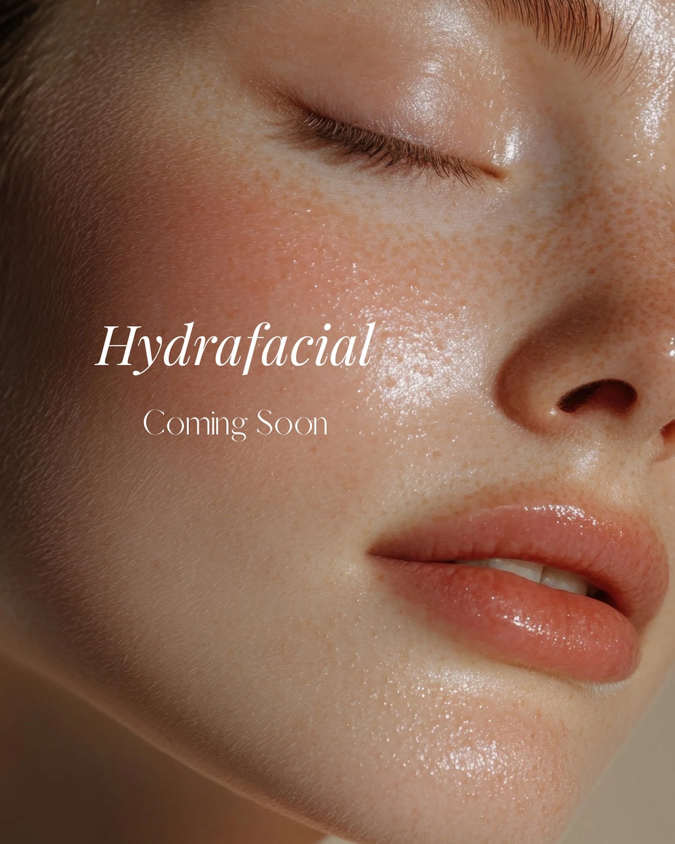 ITS OFFICIAL🥳🥳🥳 

HydraFacial is coming to Allure Skin &amp; Brows.
This is the ultimate results-driven facial that deeply cleanses, exfoliates, and hydrates &mdash; with zero downtime. Combined with skin boosters to target different concerns and 