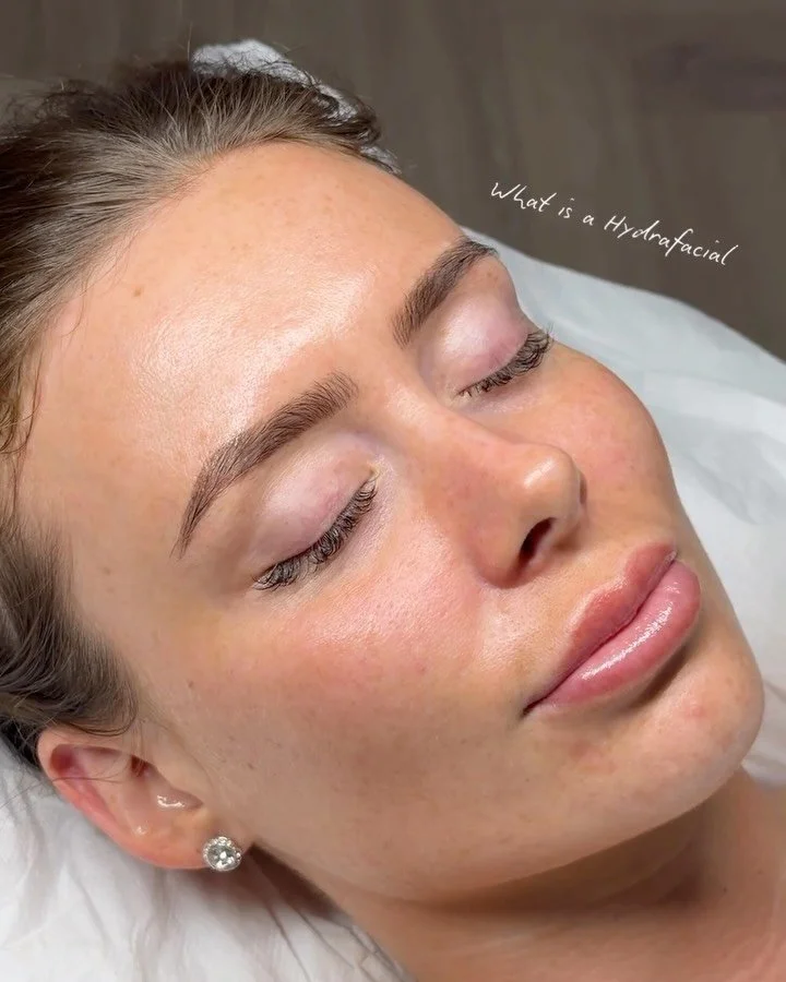 What is a Hydrafacial? ✨💁🏼&zwj;♀️

This 8 step treatment is suitable for all types, it is the ultimate maintenance for your skin and targets the most concerns in one treatment than any other facial. 👀

🤍 Our most popular Platinum Plus @hydrafacia