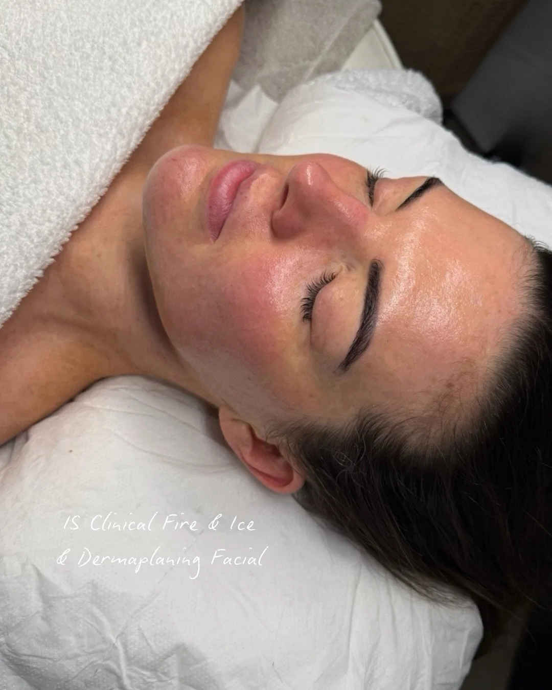 Today officially marks the first day of spring 🌷 🌺 ☀️ 🐰 

Which means now is the time for pre summer skin prep &amp; the start of new ombr&eacute; brow season! April ombr&eacute; brows need one session 1 month later and will be fully healed and co