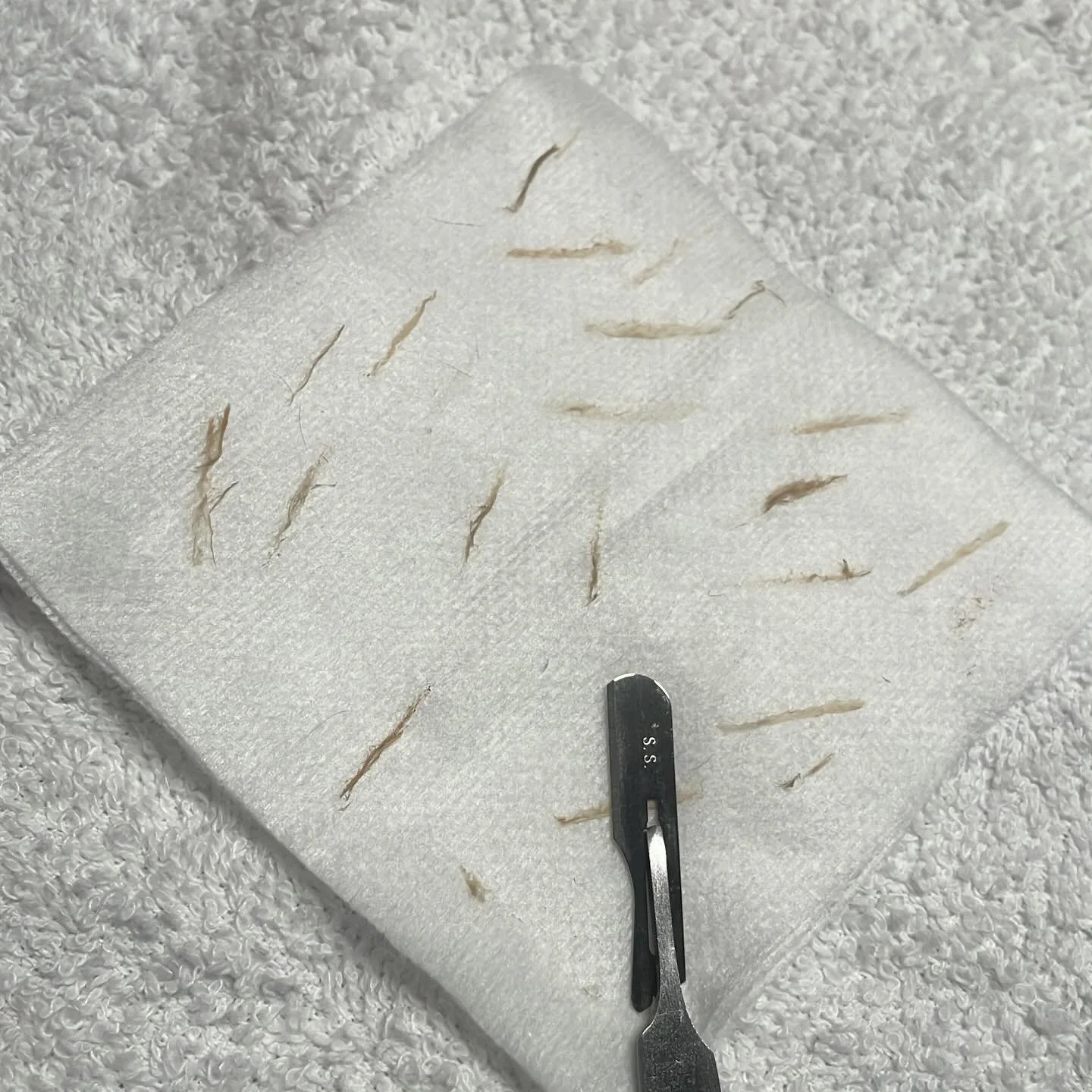 How satisfying is freshly dermaplaned skin?!🤩

What does it do?
&bull;Exfoliates the skin, leaving it smoother and brighter. 
&bull;Removes the fine, soft facial hair known as &ldquo;peach fuzz&rdquo;
&bull;Enhances product absorption by removing de