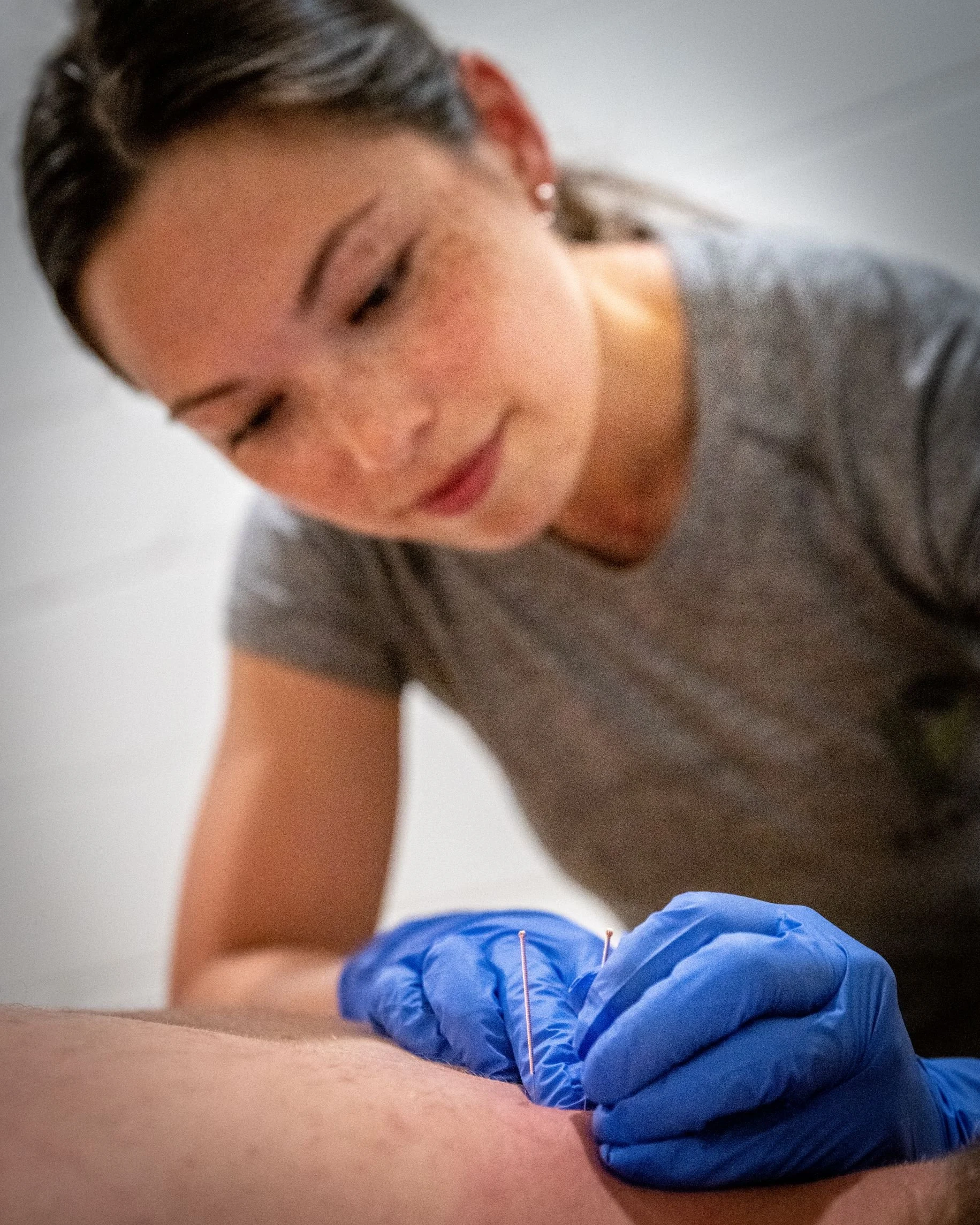What does Dry Needling Do? — Pursuit Physiotherapy