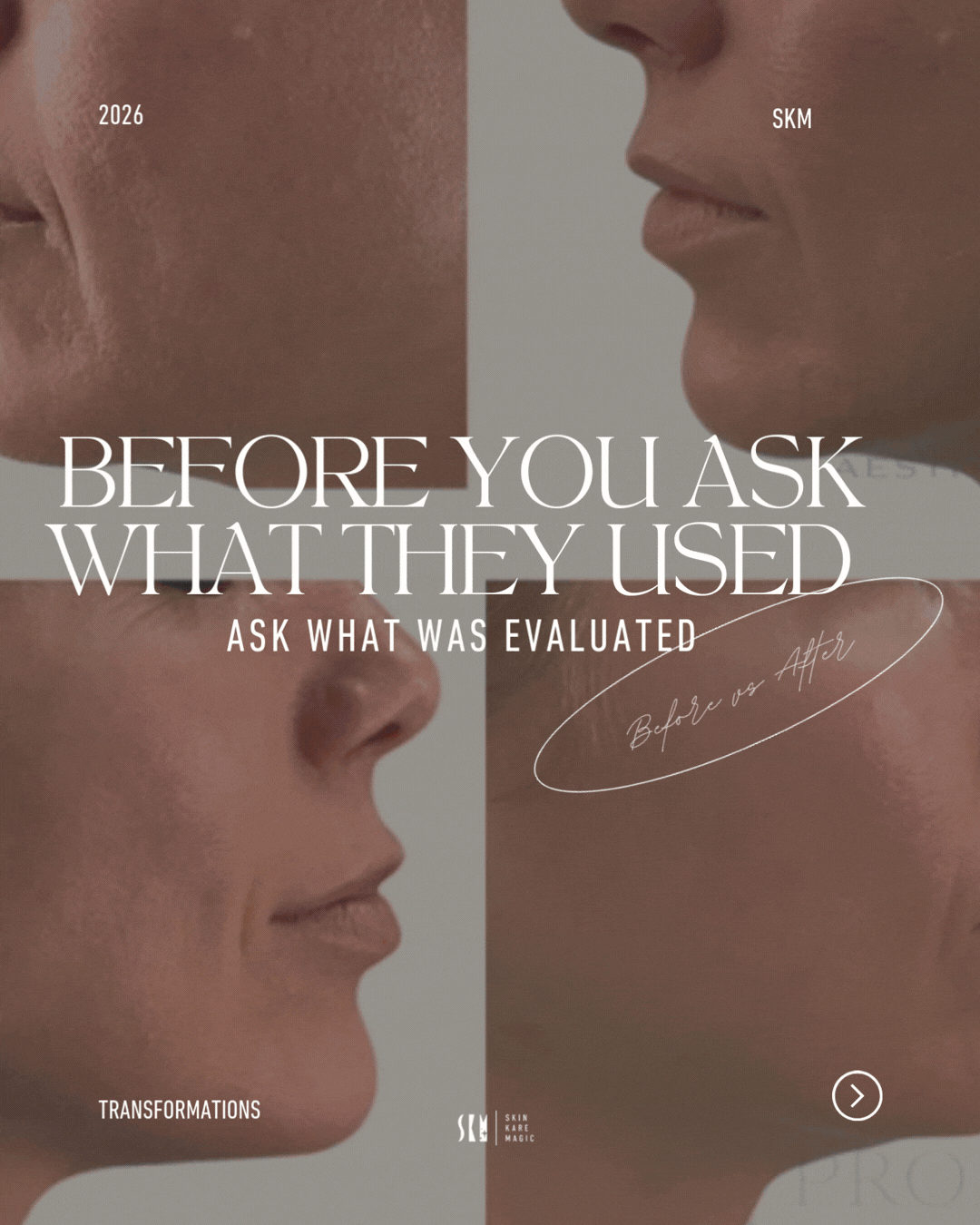 SKM carousel posts (1).gif